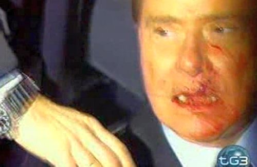 Berlusconi ferito al volto. Il premier: “Troppo odio”