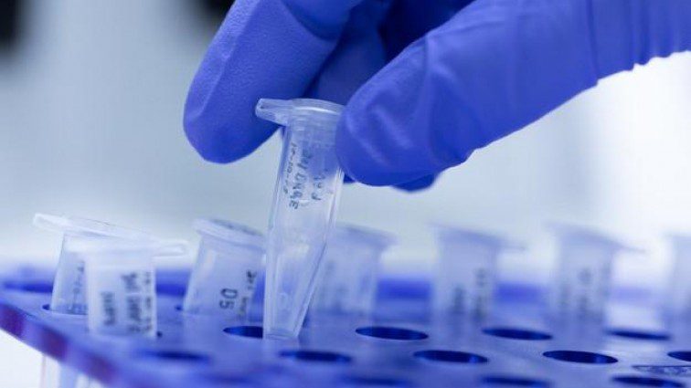 Coronavirus, la Regione Campania acquista test rapidi per screening di massa