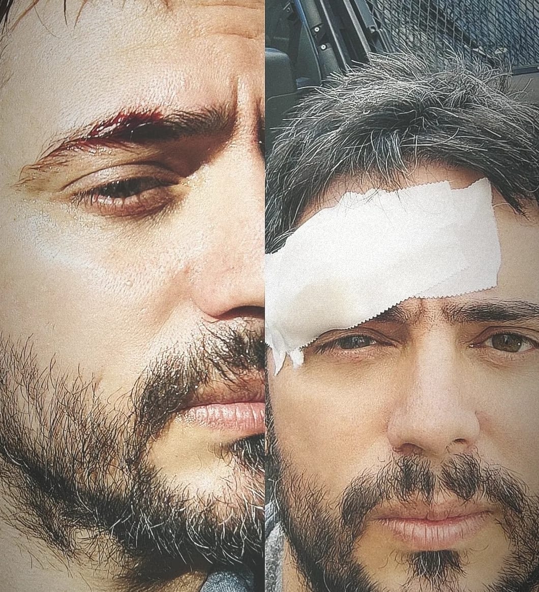 Scontri a Napoli durante manifestazione pro Palestina: ferito fotoreporter salernitano