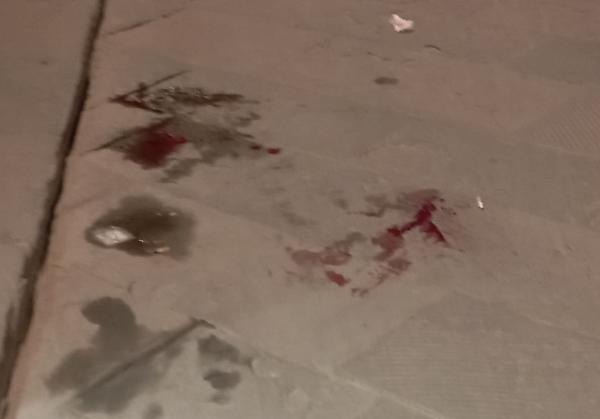 Violenta rissa nella notte, spunta un coltello: un ferito grave
