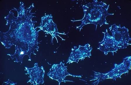 Cancro, arriva il farmaco smart che si attiva solo nelle cellule malate