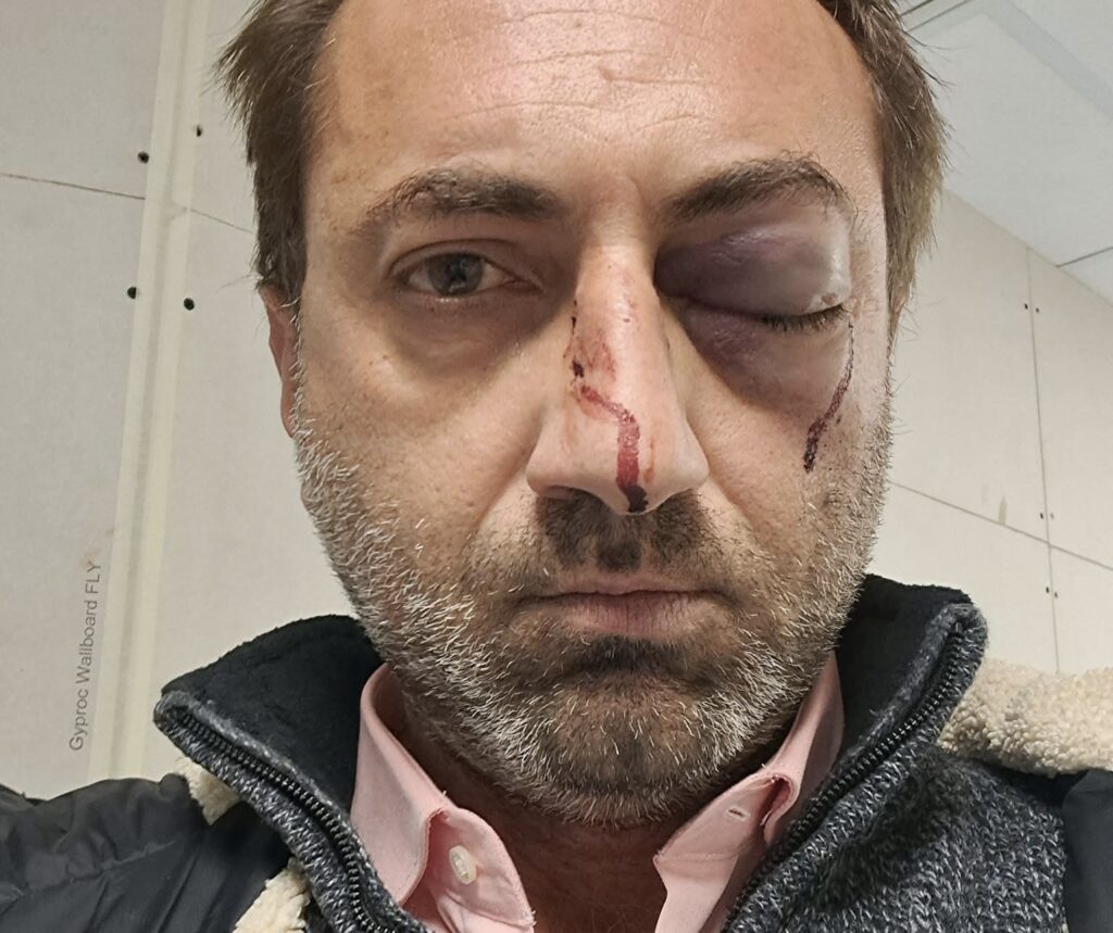 Aggressione di Capodanno a Vallo della Lucania: individuato il presunto responsabile