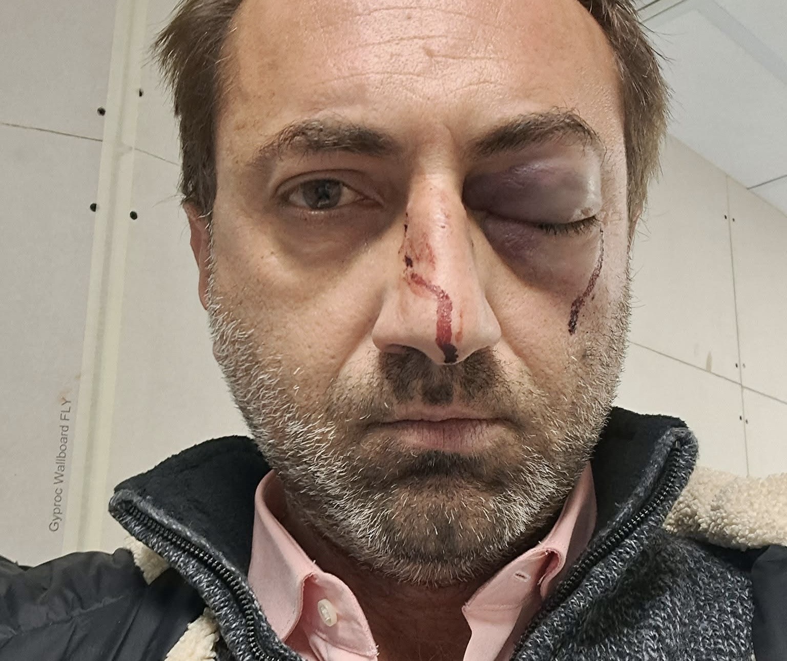 Capodanno violento a Vallo della Lucania: medico aggredito in piazza