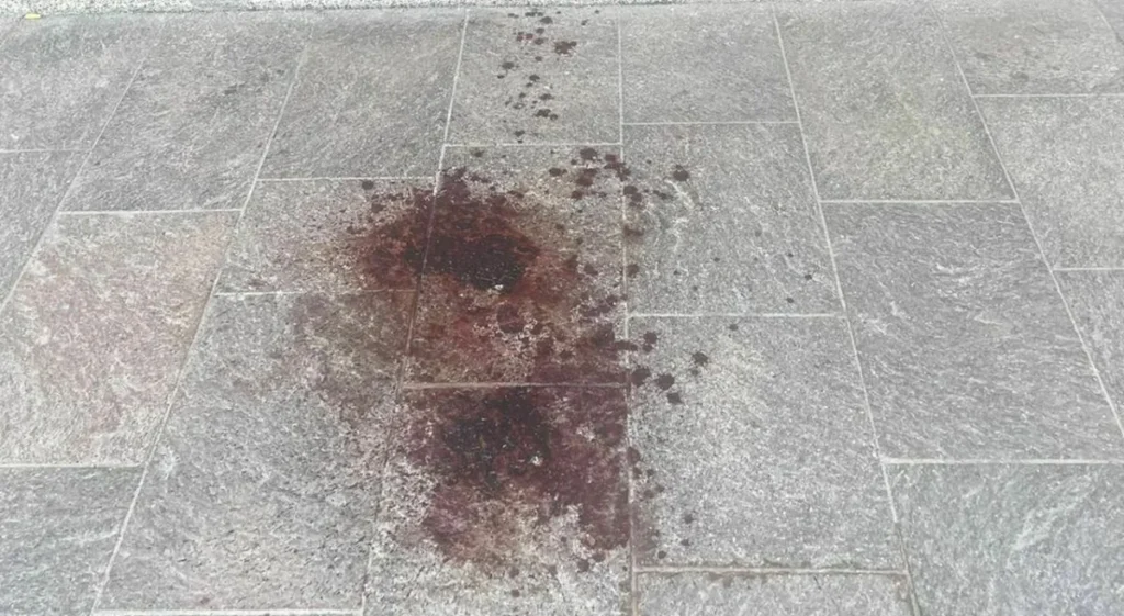 Salerno, bimba di due anni azzannata alla testa: è caccia ai padroni del cane