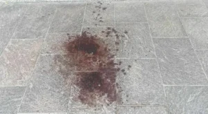 Salerno, bimba di due anni azzannata alla testa: è caccia ai padroni del cane