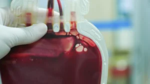 Carenza di sangue critica nel Cilento: appello urgente per il gruppo 0 Rh negativo