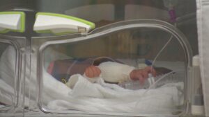 Buone notizie dall’ospedale Mondali, la piccola Teresa si è svegliata: «Piange e si muove»