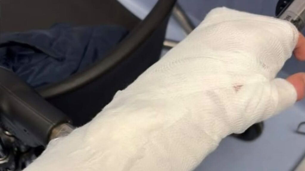 Palomonte–Pro Teggiano, attaccante finisce in ospedale con un braccio rotto: è polemica