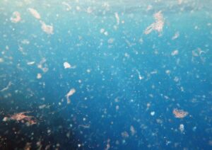 Plastica nel corpo umano: cosa sappiamo davvero sulle microplastiche