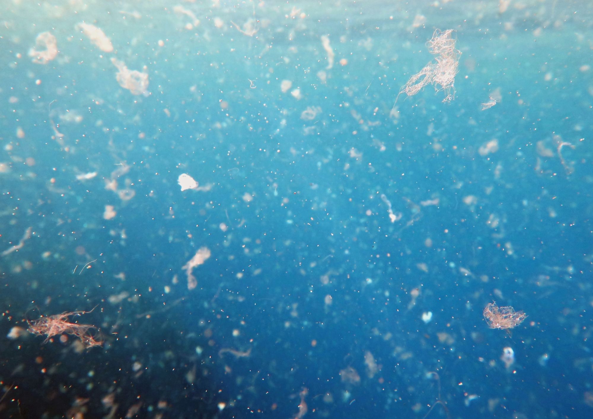 Plastica nel corpo umano: cosa sappiamo davvero sulle microplastiche