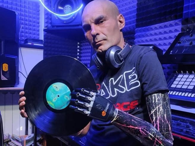 Padula: la Giunta chiede onorificenza al Merito della Repubblica per Miky Bionic