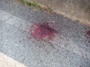 Grave incidente a Torre Orsaia: bambino di 10 anni trasferito in elicottero al Santobono di Napoli