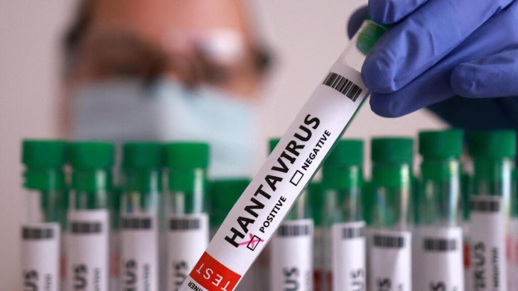 Catalogna, isolata donna entrata in contatto con turista morta dopo focolaio di hantavirus