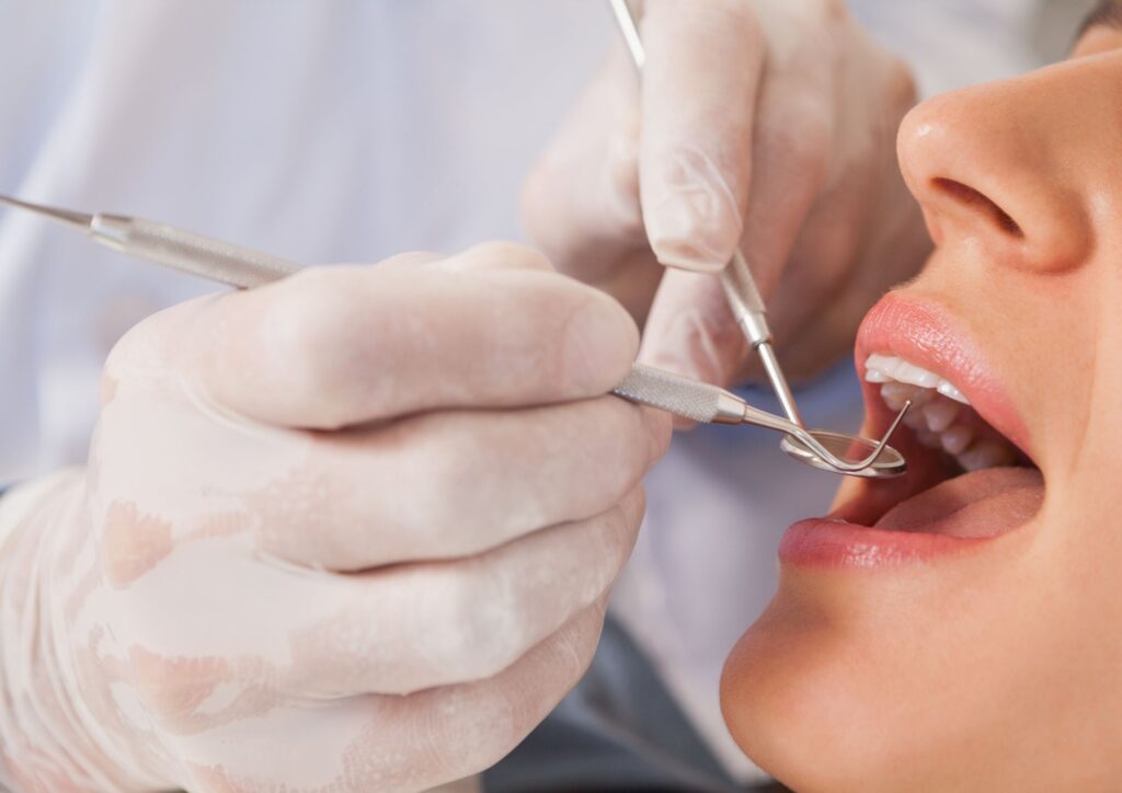 Cassazione: il danno odontoiatrico include le spese future per le cure necessarie