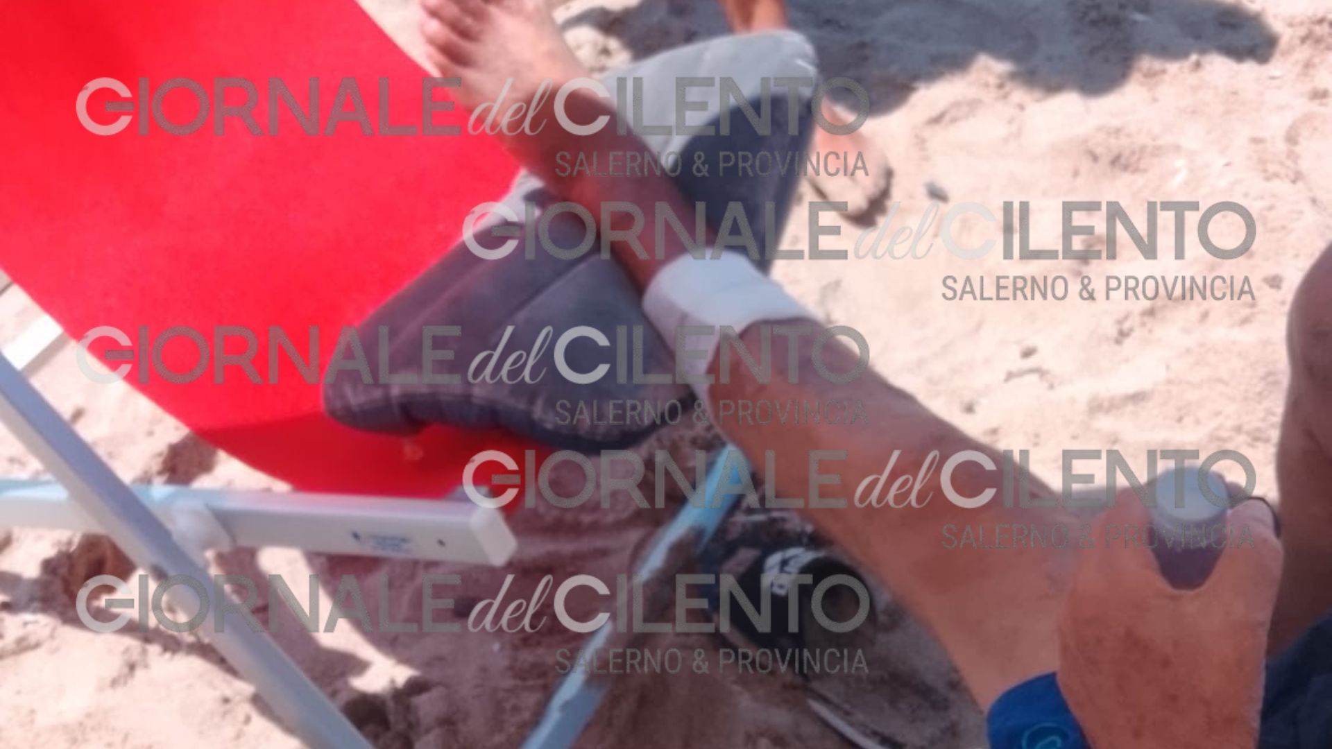 Cilento, un altro turista morso da un pesce: è il secondo in tre giorni