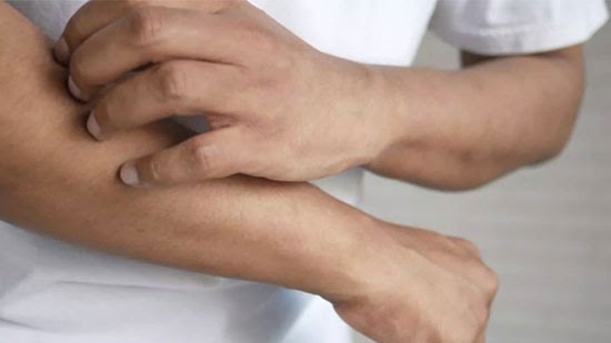 Contro fake news su malattie dermatologiche: ecco il glossario Apiafco