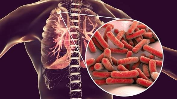 Eboli, sospetto caso di tubercolosi: scattano i protocolli
