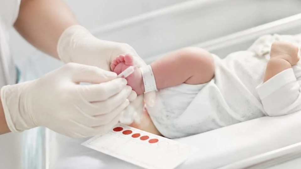 Leucodistrofia, in Campania al via nuovo screening neonatale per la diagnosi precoce